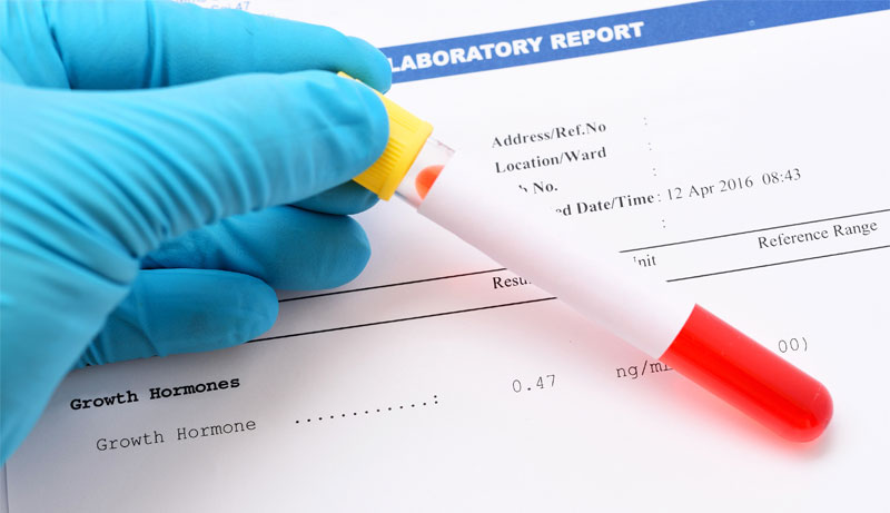 What If Your Blood Test Indicates Growth Hormone Deficiency?