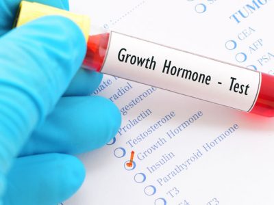 Blood Testing for Growth Hormone Levels