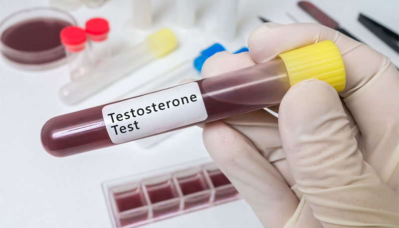 How to Tell If I Need Testosterone Therapy?