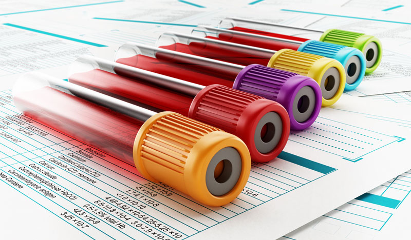 How Do I Prepare for My Testosterone Blood Test?