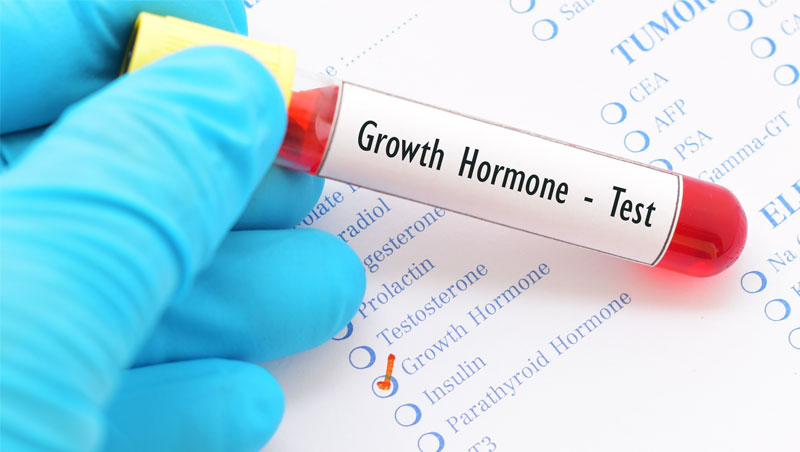How Do We Test for Low Testosterone or Low HGH?