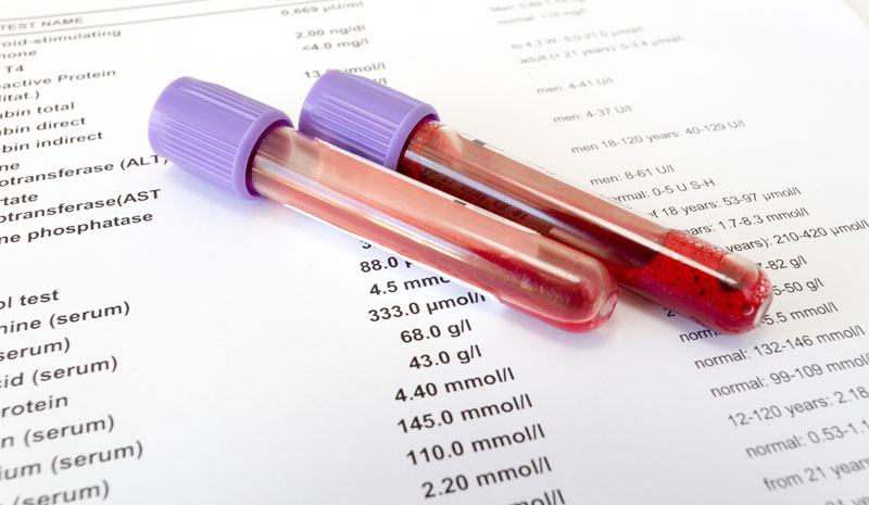 Testing For Normal Growth Hormone Levels in Adults