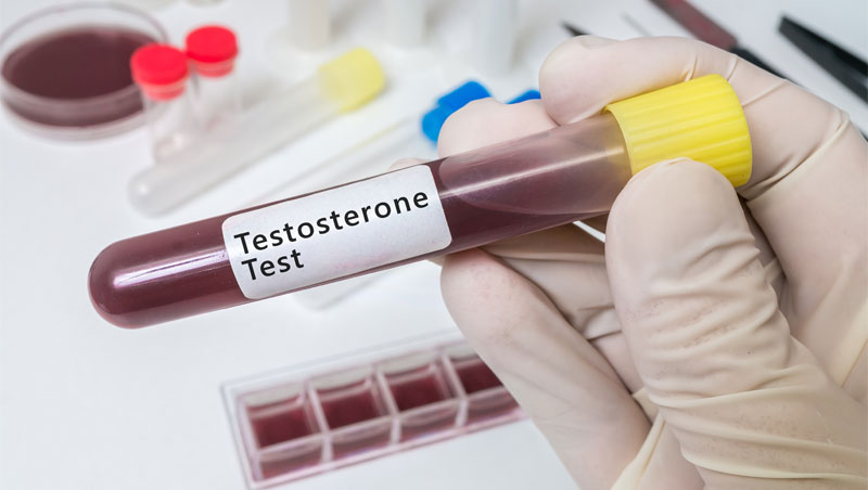 Diagnosis and Testing for Low Testosterone
