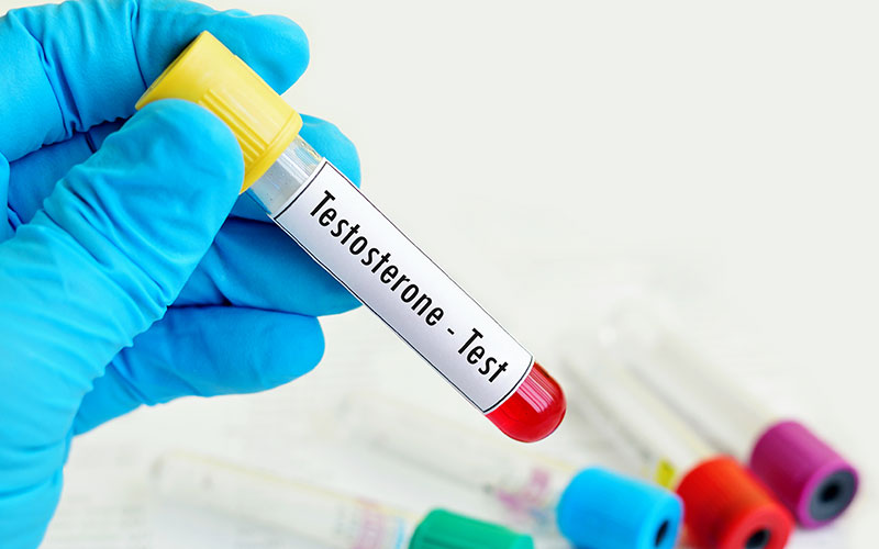 Normal Testosterone Levels