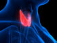 Hyperthyroidism