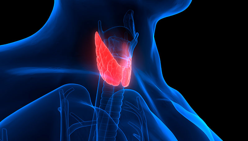 Hyperthyroidism