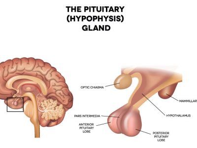 Understanding Growth Hormone Deficiency